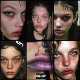 Kai Angel – hurt